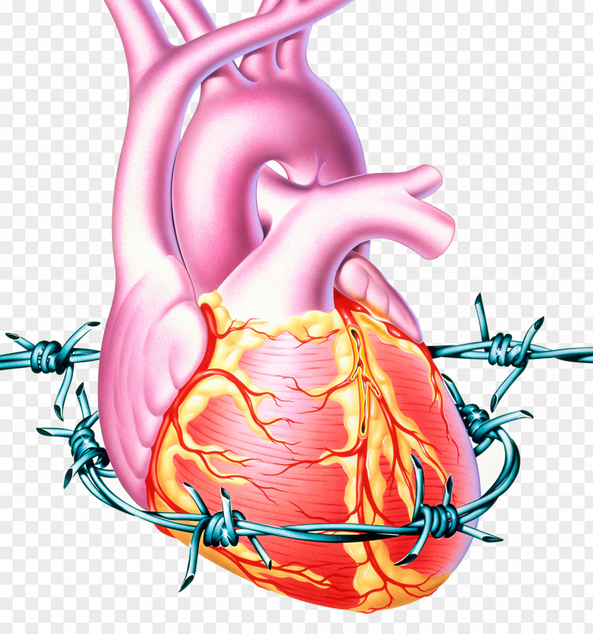 Cholesterol Coronary Heart Disease Angina Pectoris Cardiopatia Isquxe8mica Ischemia PNG