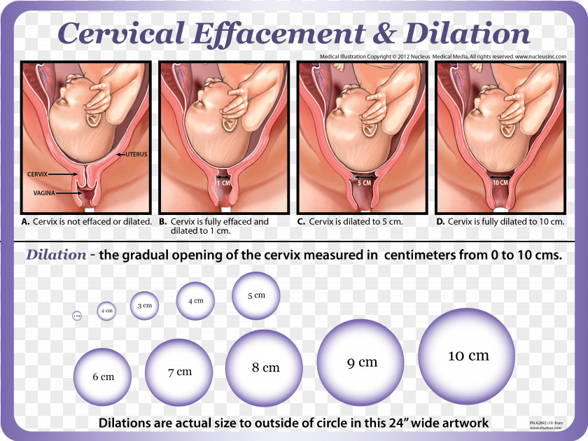Prenatal Education Cervical Effacement Dilation Cervix Childbirth PNG