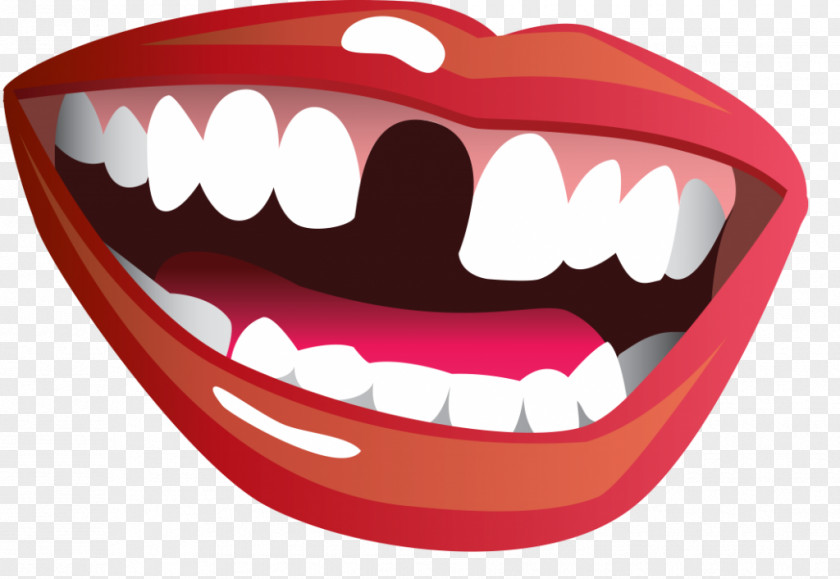Smile Mouth Tooth Loss Clip Art PNG