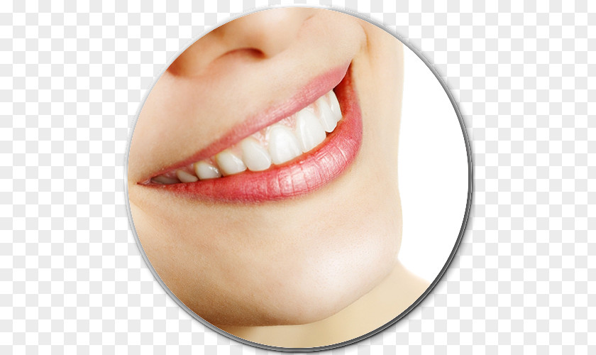 Bleach Tooth Whitening Dentistry PNG