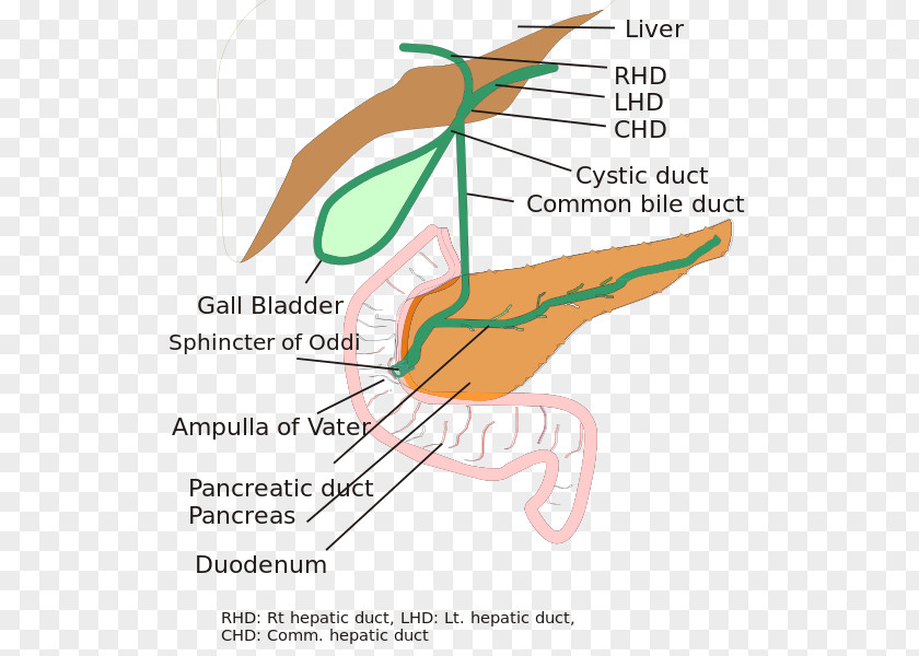 Spina Biliary Atresia Tract Bile Duct PNG