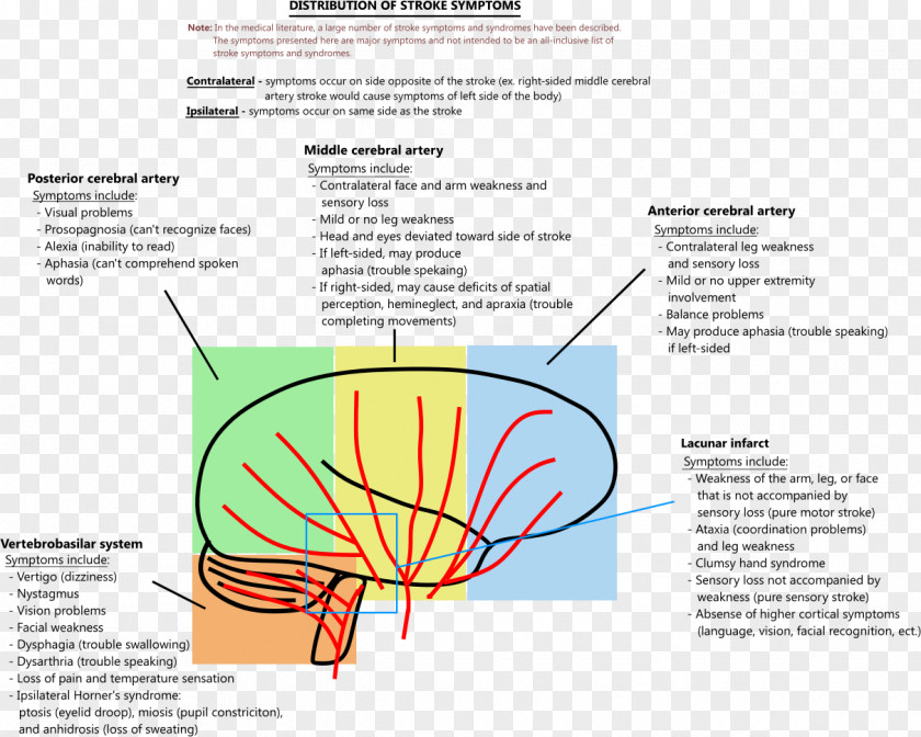 Cerebral Lacunar Stroke Symptom Posterior Artery Middle PNG