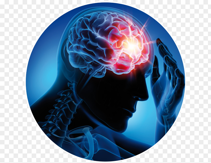 Head Injury Neurological Disorder Neurology Epilepsy Neurorehabilitation Epileptic Seizure PNG