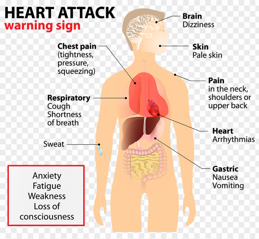 Heart Acute Myocardial Infarction Cardiovascular Disease Health PNG