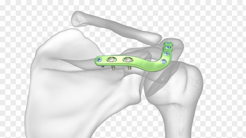 Fracture Definition Thumb Acromion Shoulder Joint Scapula PNG