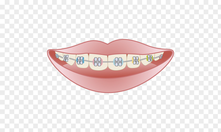 Dental Braces 矯正歯科 Dentistry Mouthguard PNG