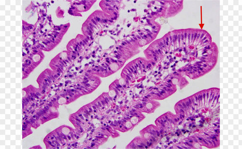 Irregular Border Microvillus Small Intestine Duodenum Histology Microscope Slides PNG