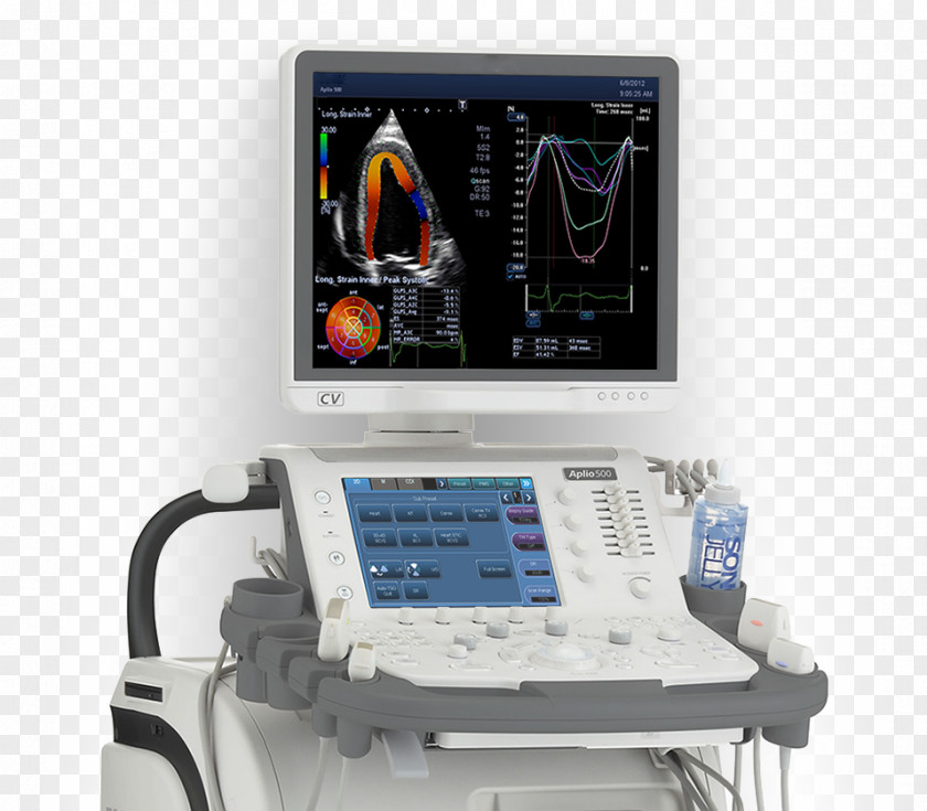 Ultrasound Ultrasonography Medicine Portable SonoSite, Inc. Medical Imaging PNG