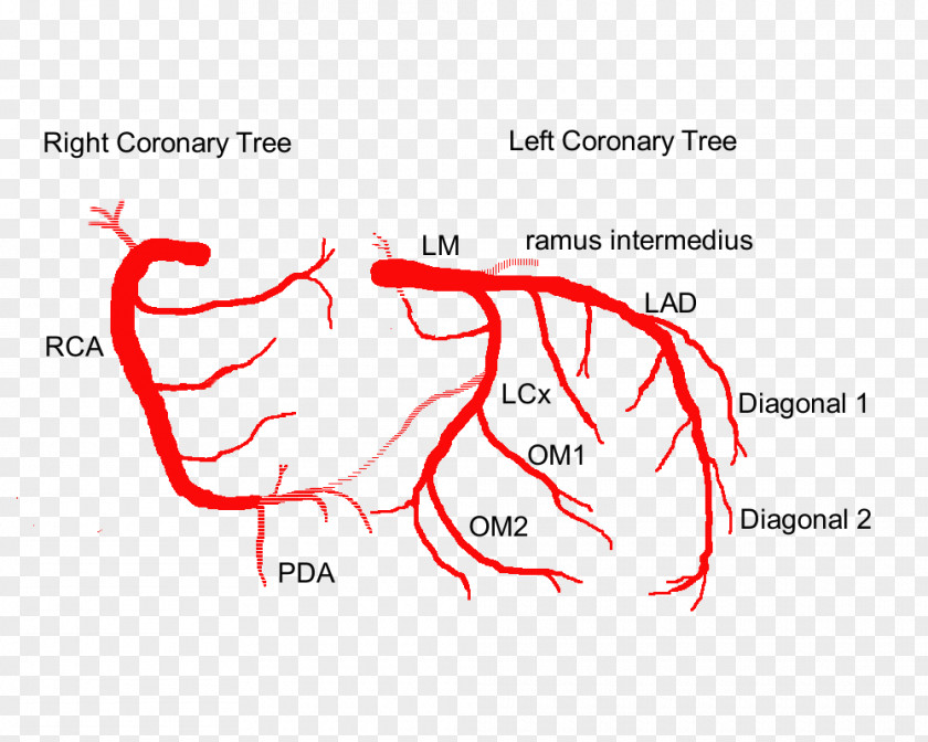 Heart Coronary Arteries Left Artery Anatomy PNG