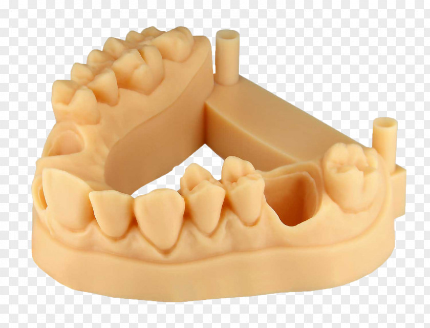 Crown Tooth 3D Printing EnvisionTEC Fabrication Additive, Impression 3D. PNG
