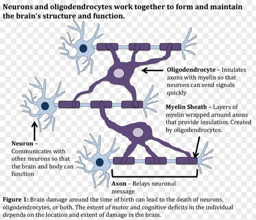 Child Cerebral Palsy Stem-cell Therapy Stem Cell Neuron PNG