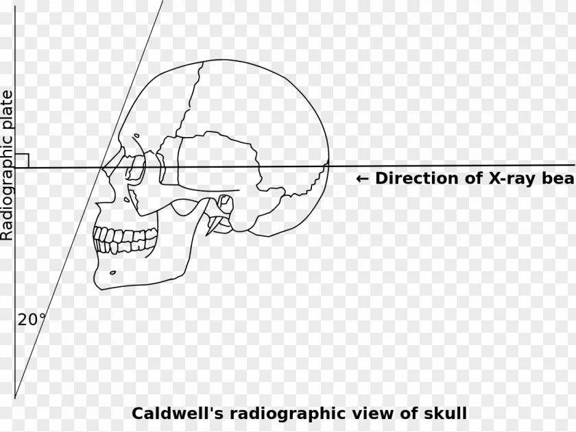 Caldwell's View Orbitomeatal Line /m/02csf Document Angle PNG