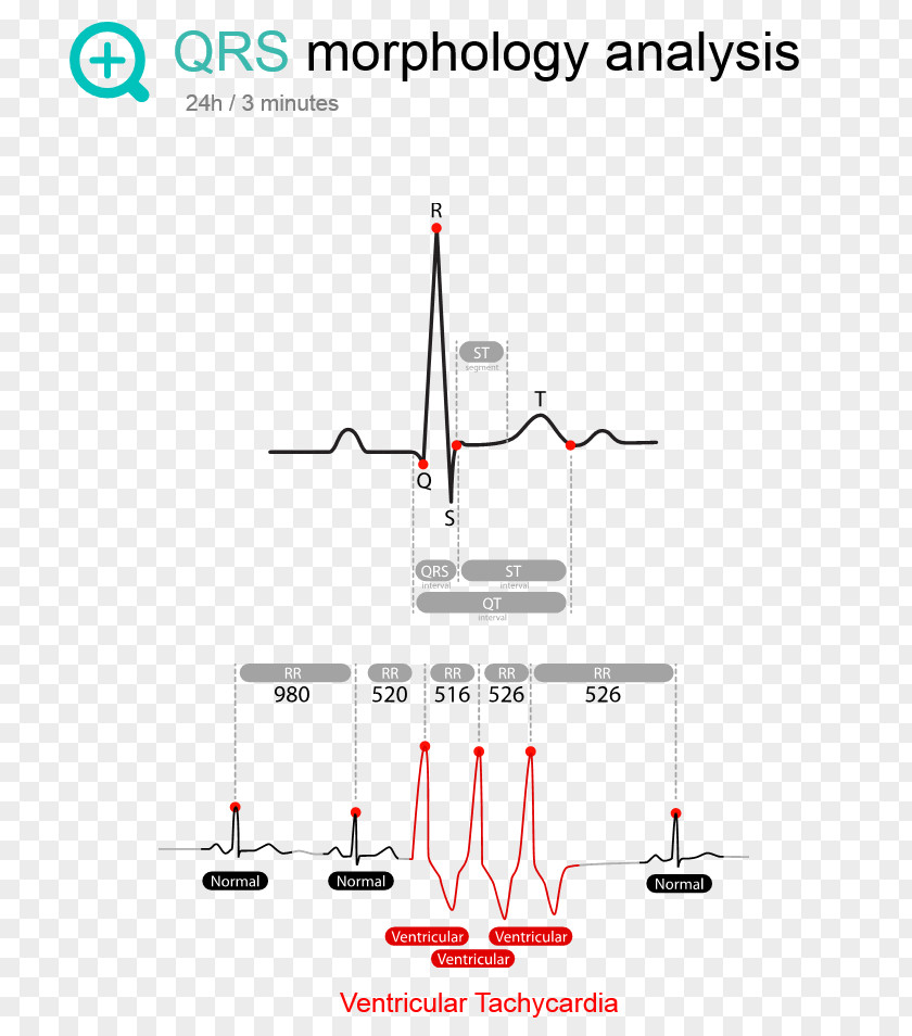 Ecg Monitor Line Point Angle PNG