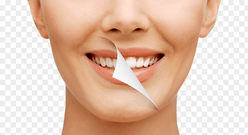 Smile WOMAN Freedom Dental Cosmetic Dentistry Makeover PNG
