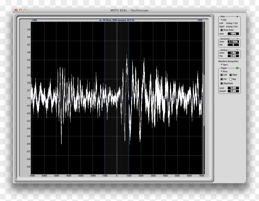 Pause Button Oscilloscope Waveform Wiring Diagram Display Device Sound PNG