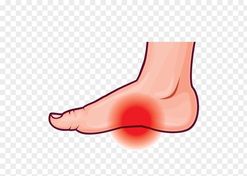 Thumb Arches Of The Foot Podalgia Plantar Fasciitis PNG