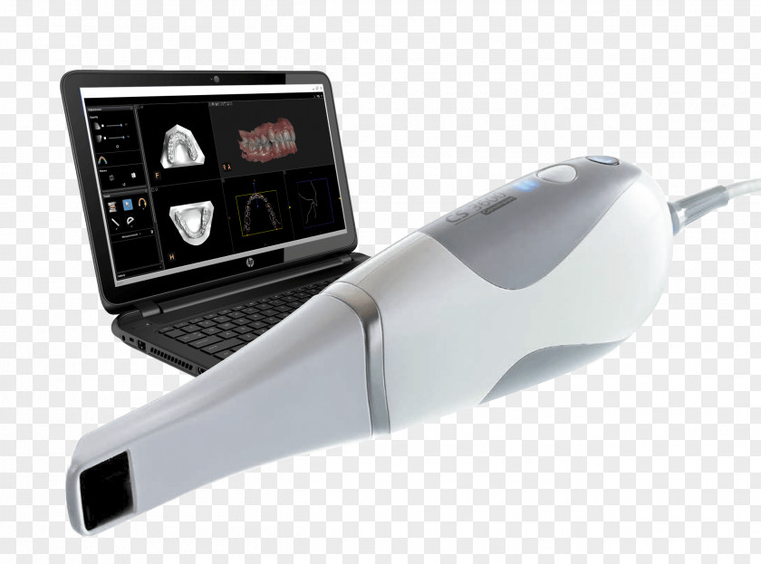 Ceram Image Scanner Digital Data 3D Fingerprint Radiography PNG
