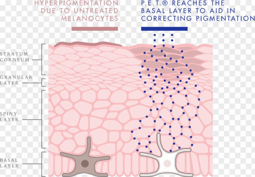 Glycyrrhiza Melanocyte Melanin Skin Hyperpigmentation Tyrosinase PNG