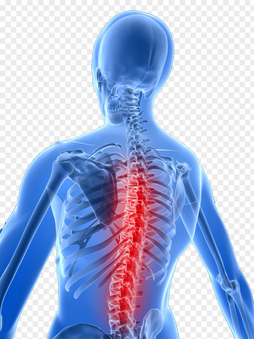 Pain Back Vertebral Column Chiropractic Therapy Health Care PNG