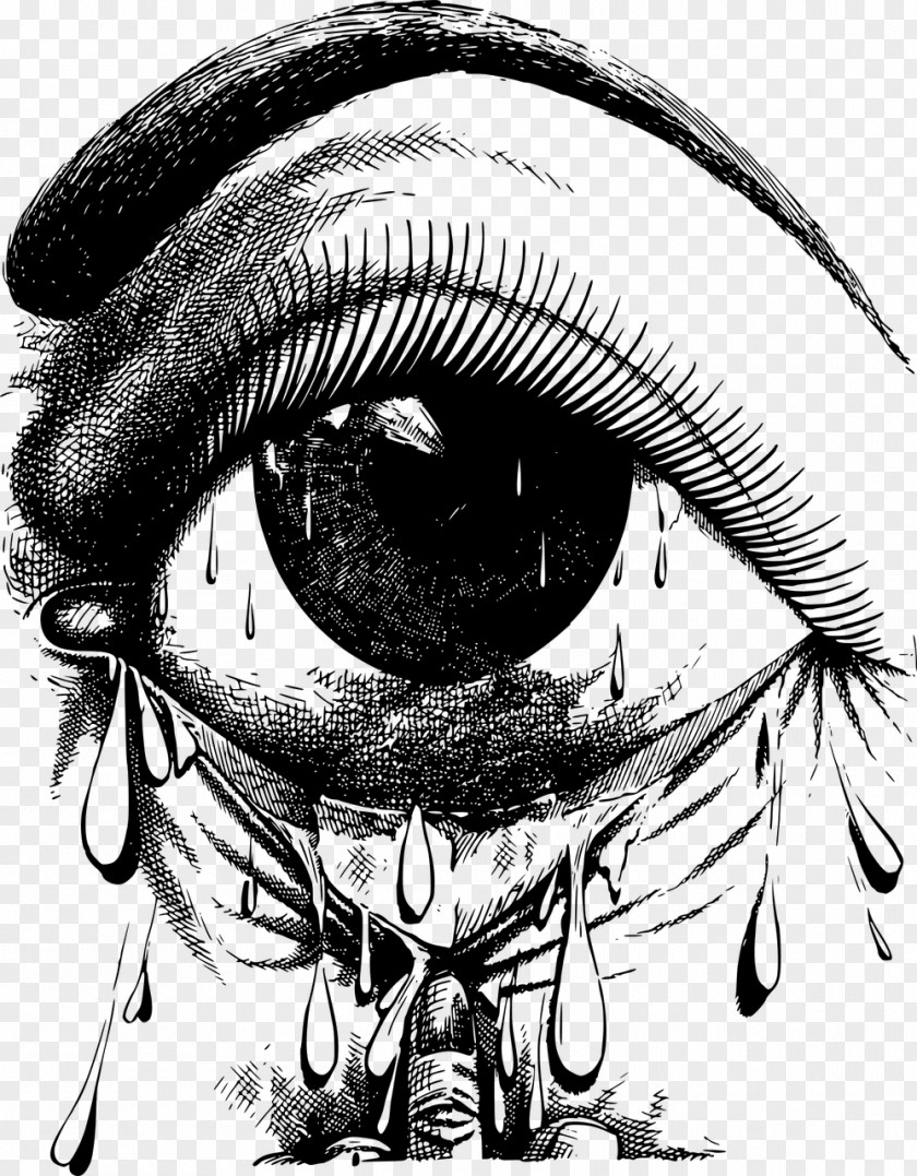 Allergy Eye Crying Clip Art PNG