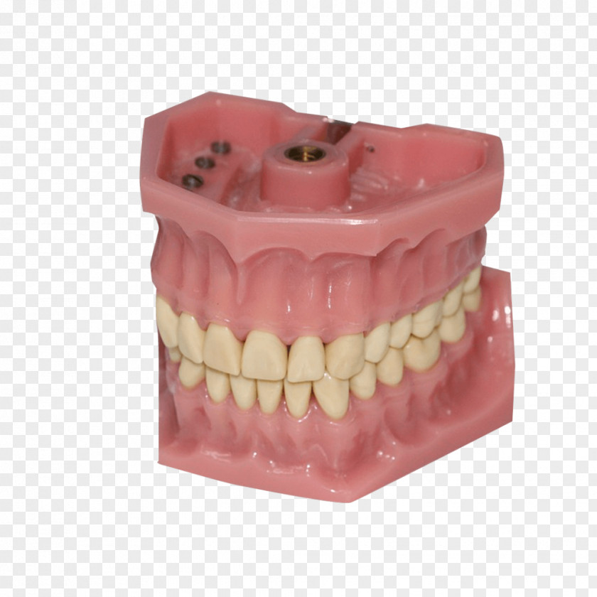 3d Dental Treatment For Toothache Dentistry Human Tooth Dentures Bruxism PNG
