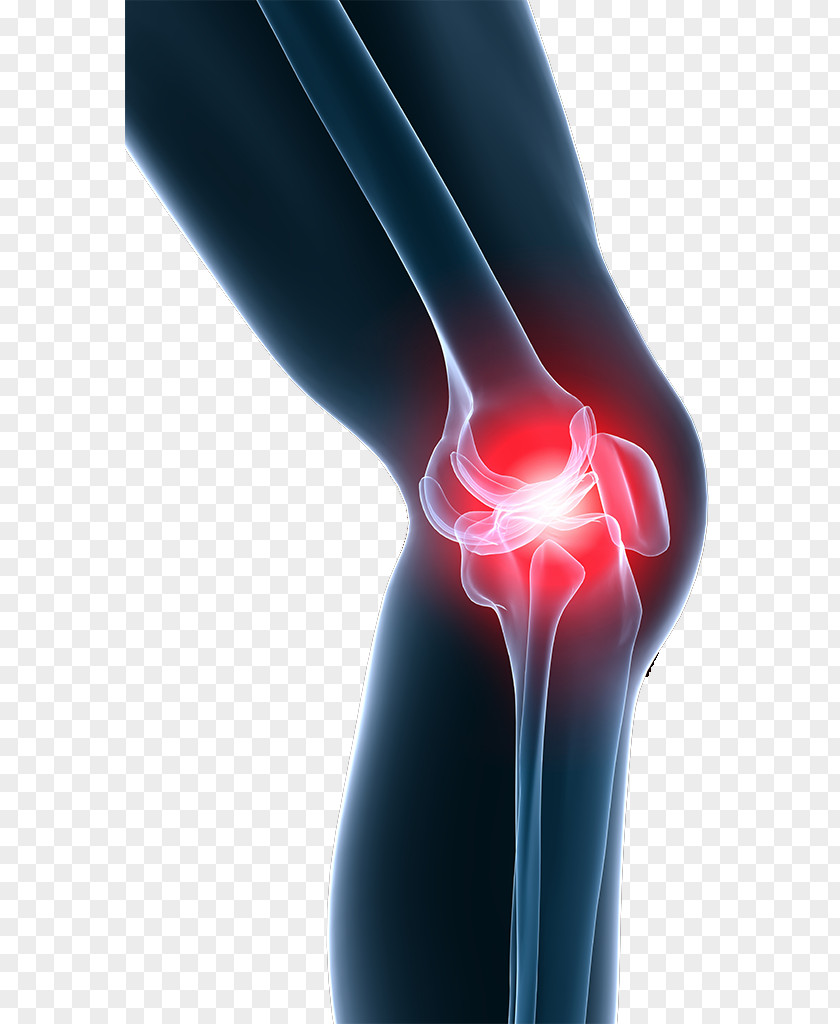 Knee Pain Shoulder Stem-cell Therapy PNG