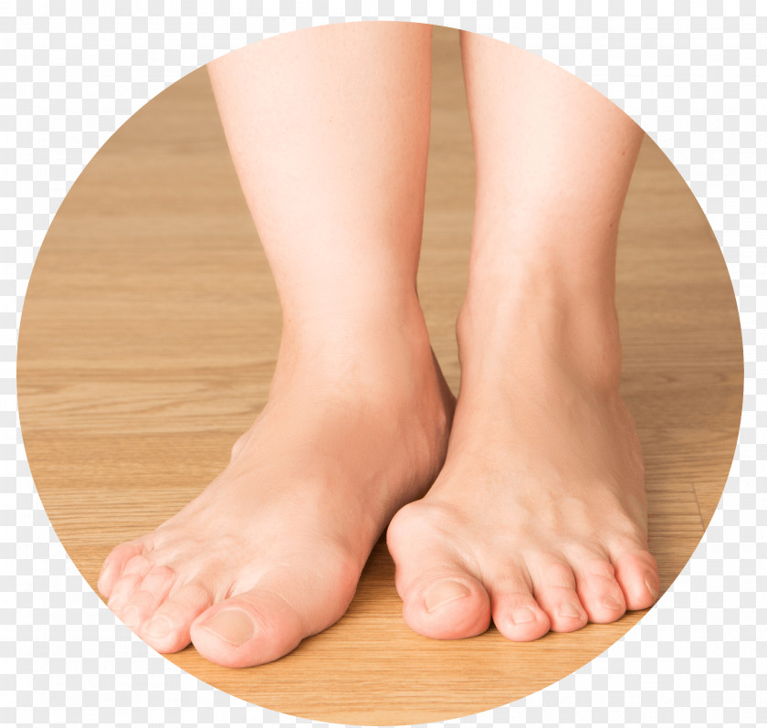 Podiatry Bunion Foot Toe Plantar Fasciitis PNG