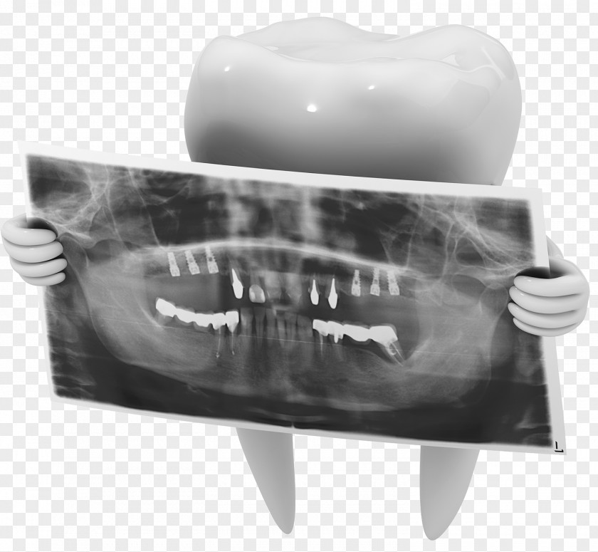 Dental X-ray Film Radiography Dentistry Tooth PNG