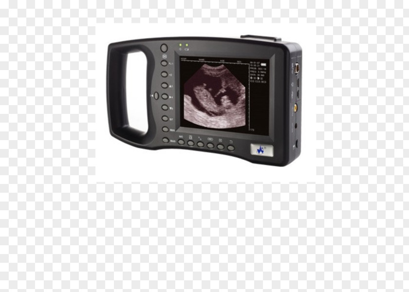 Ultrasound Machine Ultrasonography Medicine Medical Diagnosis Doppler Echocardiography PNG