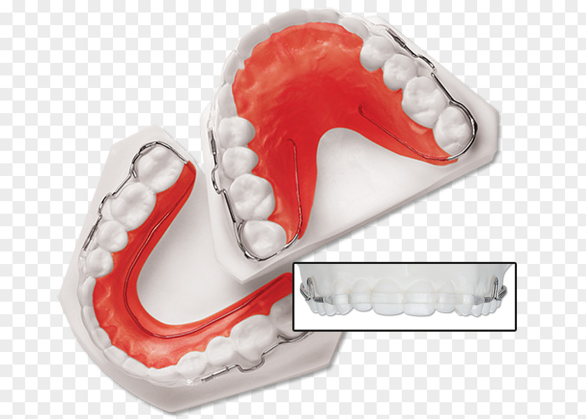 Retainer Tooth Orthodontics Dentistry Dental Braces PNG