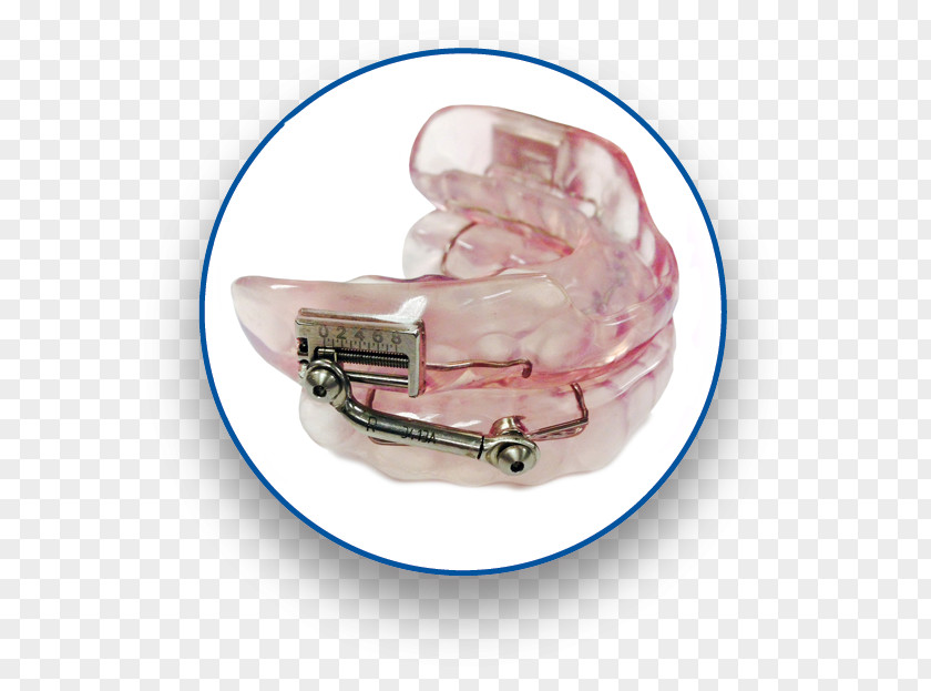 Snoring Mandibular Advancement Splint Obstructive Sleep Apnea Dentistry PNG