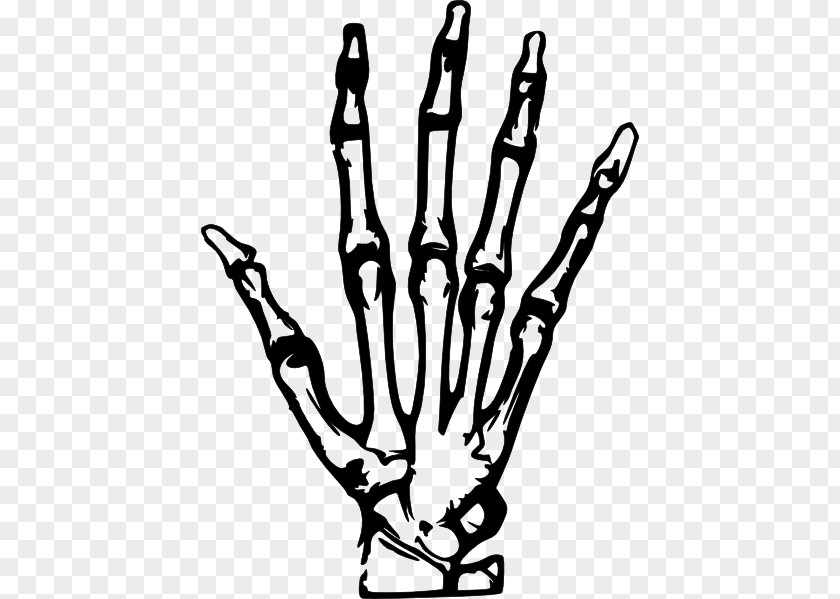 X-Rays Cliparts Hand X-ray Clip Art PNG