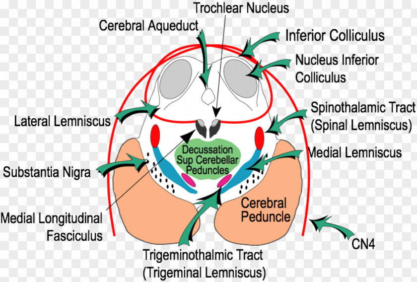 Brain Inferior Colliculus Superior Midbrain Tectum Brainstem PNG