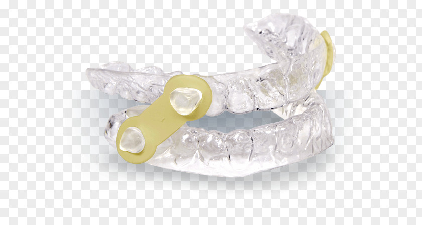 Snoring Mandibular Advancement Splint Mandible Dentistry Jaw PNG