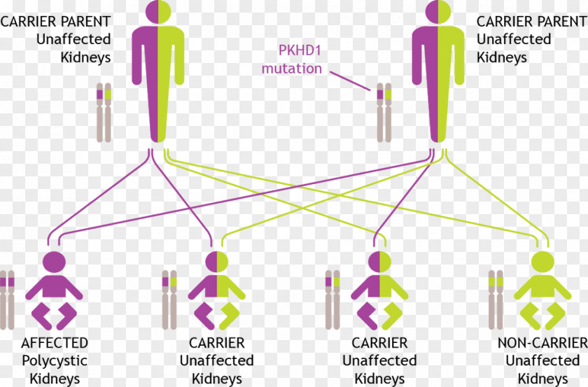 Polycystic Liver Disease Autosomal Recessive Kidney Genetic Testing Dominant Genetics PNG