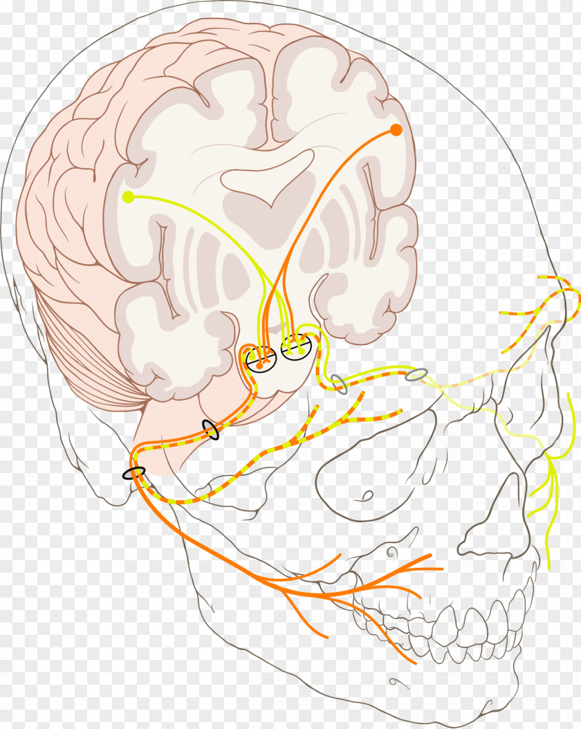 Nerve Structure Facial Canal Paralysis Bell's Palsy Internal Auditory Meatus PNG