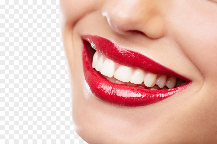 Teeth Model Bleach Tooth Decay Smile Dentistry PNG
