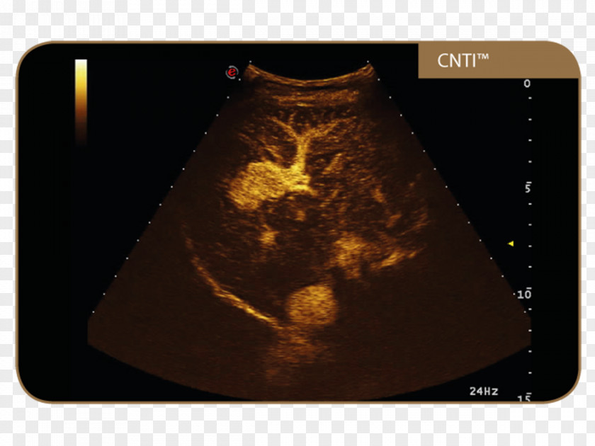 Technology Esaote Ultrasonography Contrast-enhanced Ultrasound Contrast Agent PNG