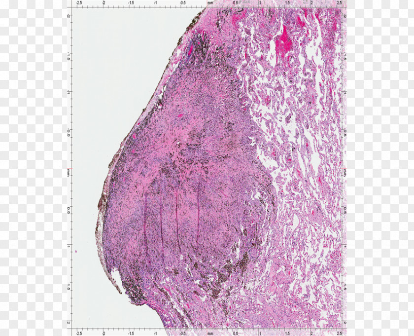 Pleural Cavity Silk Pink M PNG