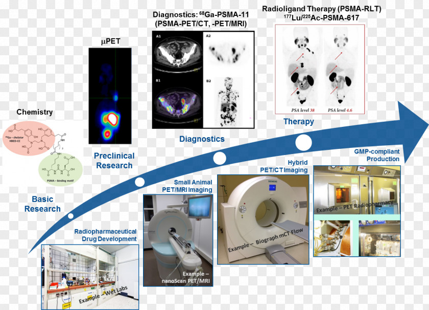 Drug Development German Cancer Research Center Radiation Therapy Prostate-specific Antigen PNG