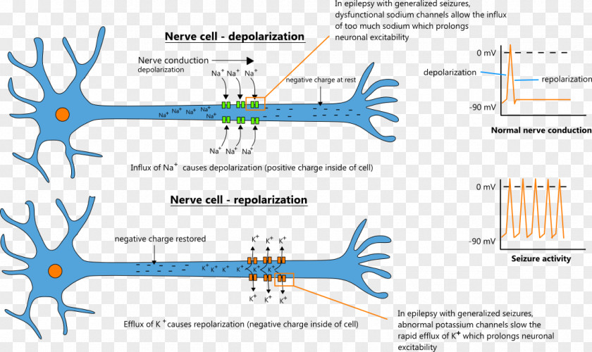 Nerve Epilepsy Depolarization Sodium Channel Neuron Epileptic Seizure PNG