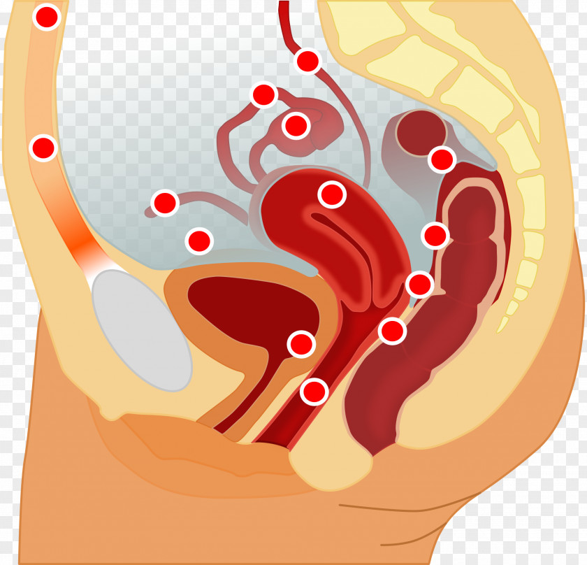 Internal Organs Endometriosis Endometrium Pelvic Pain Uterus Disease PNG