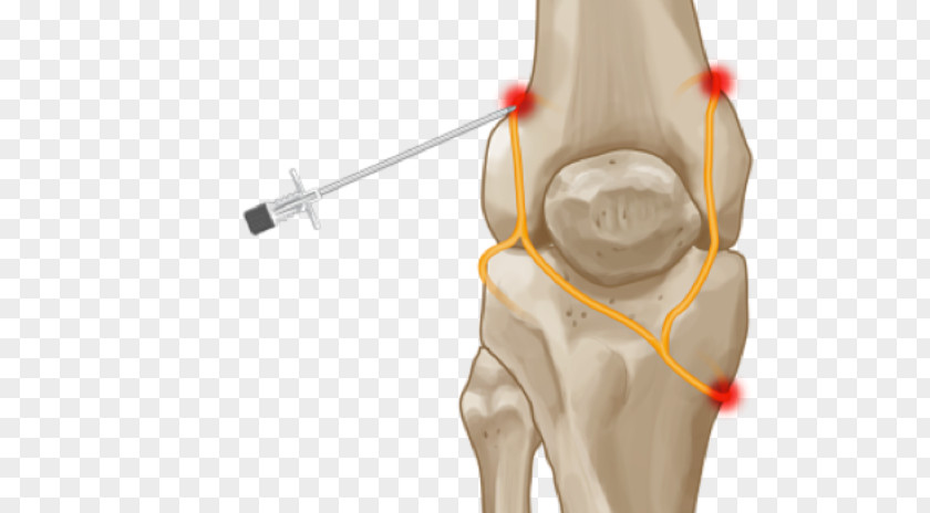 Knee Pain Hip Genicular Artery Nerve Joint PNG