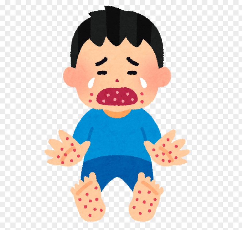 Child Hand, Foot, And Mouth Disease Infection Adenoviral Keratoconjunctivitis Blister PNG