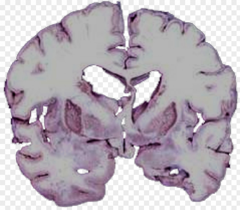 Brain Medicine Organism PNG