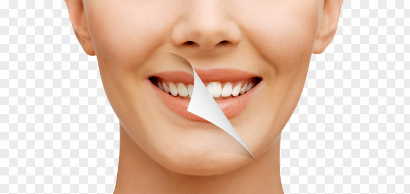 Bleach Tooth Whitening Dentistry Human PNG