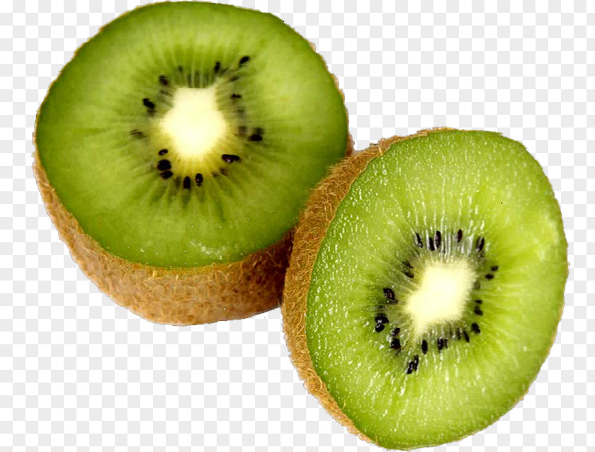 Kiwi Kiwifruit Diabetes Mellitus Auglis Blood Sugar PNG