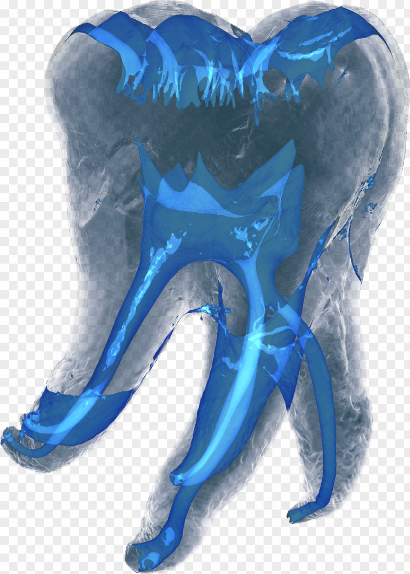 Star Ray Dentistry Computed Tomography Tooth PNG