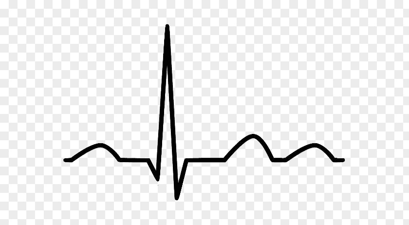 Ecg Electrocardiography Clip Art Cardiology Heart Sinus Rhythm PNG