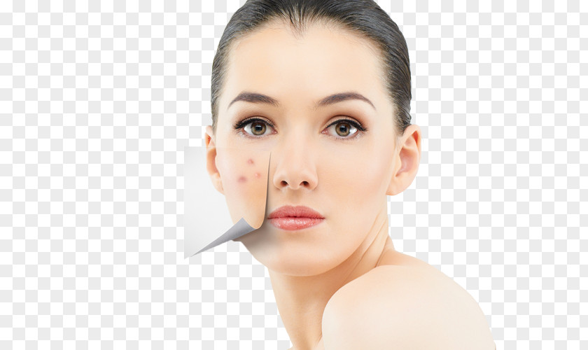 Skin Care Health Acne Diet PNG